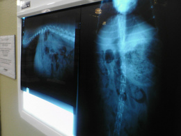 dog-xrays-chicken-bones-by-Leia.jpg