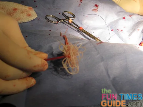 heartworms-removed-surgically
